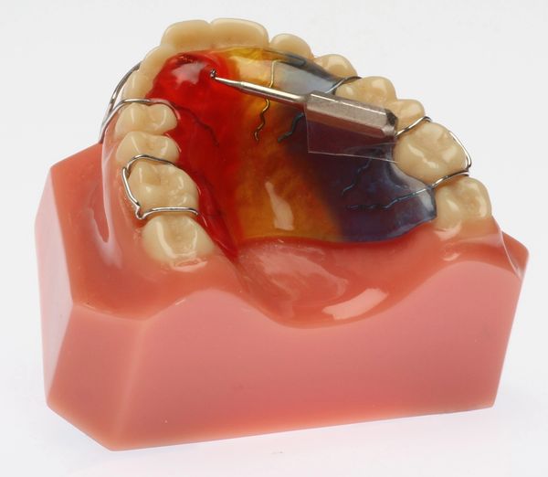 Aligners Canadian Orthodontic Laboratories